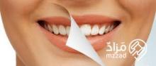 اسنان باسعار رمزيه عرض خاص للاطقم الاسنان